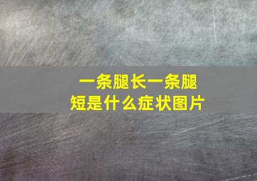 一条腿长一条腿短是什么症状图片