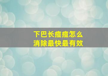 下巴长痘痘怎么消除最快最有效