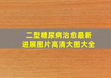 二型糖尿病治愈最新进展图片高清大图大全