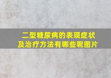 二型糖尿病的表现症状及治疗方法有哪些呢图片