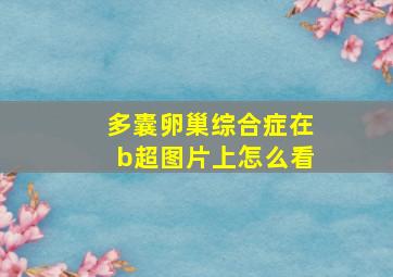 多囊卵巢综合症在b超图片上怎么看