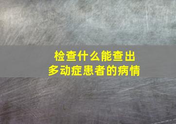 检查什么能查出多动症患者的病情