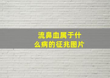 流鼻血属于什么病的征兆图片