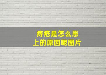 痔疮是怎么患上的原因呢图片