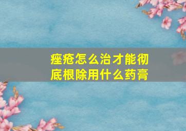 痤疮怎么治才能彻底根除用什么药膏