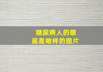 糖尿病人的眼底是啥样的图片