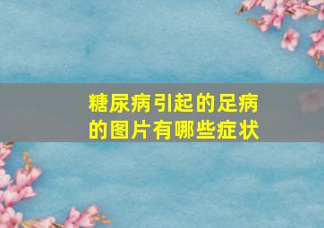 糖尿病引起的足病的图片有哪些症状