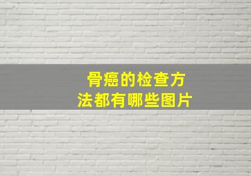 骨癌的检查方法都有哪些图片