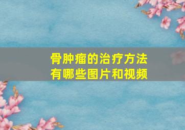 骨肿瘤的治疗方法有哪些图片和视频