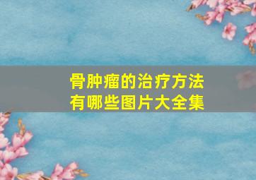 骨肿瘤的治疗方法有哪些图片大全集